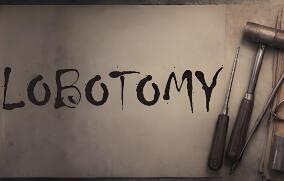 脑叶切除术/Lobotomy